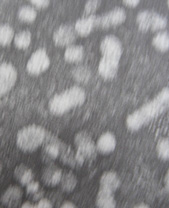 The Hepatitis B virus seen under an electron microscope