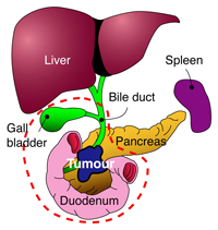 pancreas_ops_diagram-1
